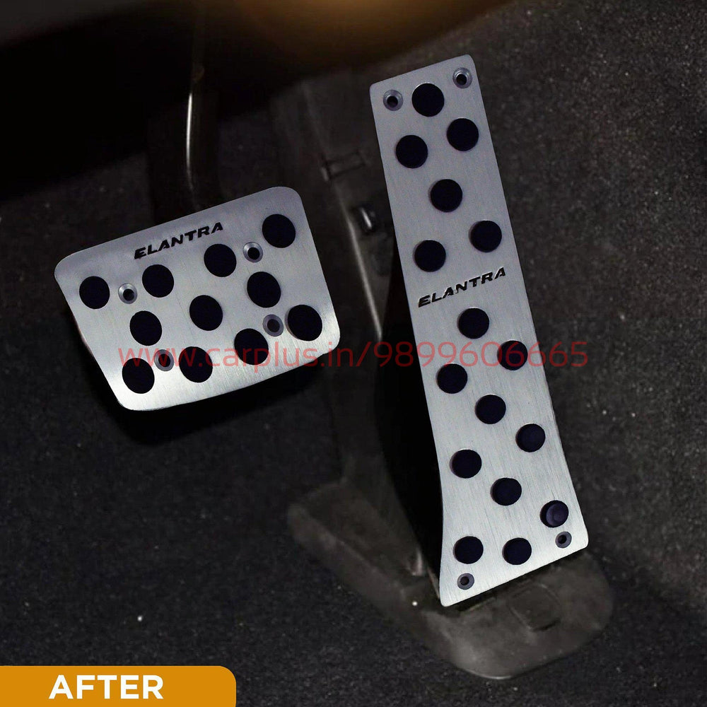 
                  
                    KMH Pedal Kit For Hyundai Elantra KMH-PEDAL KIT PEDAL KIT.
                  
                