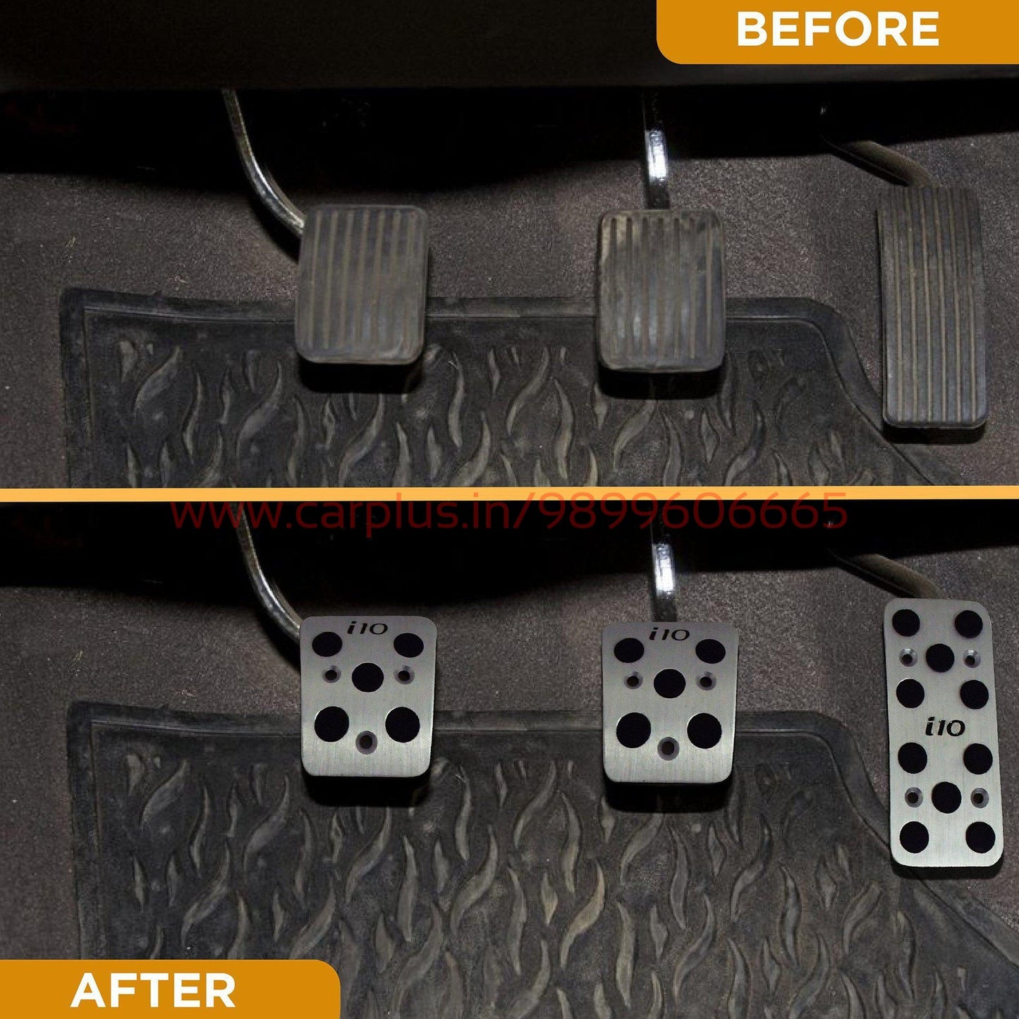 
                  
                    KMH Pedal Kit For Hyundai I10 KMH-PEDAL KIT PEDAL KIT.
                  
                