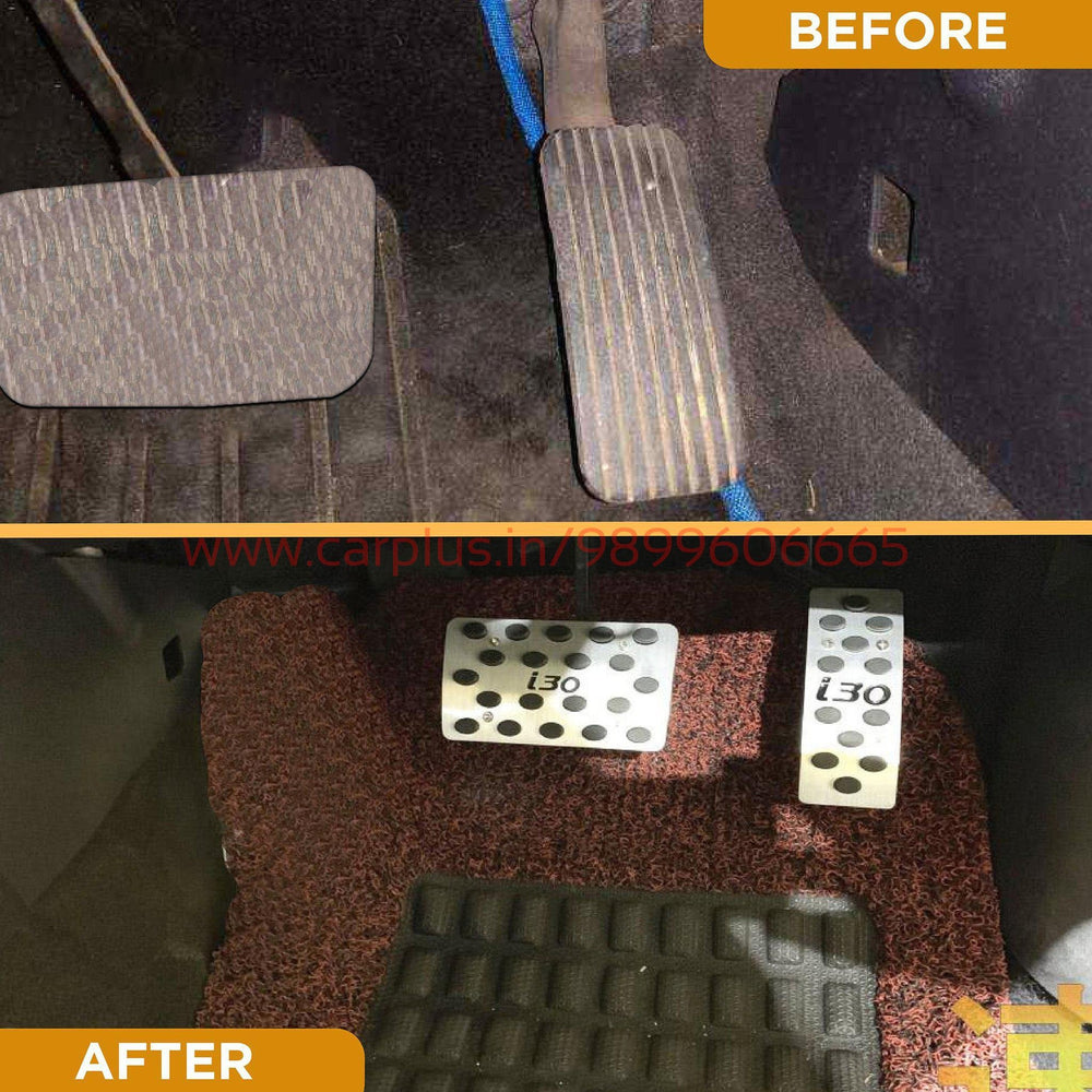 
                  
                    KMH Pedal Kit For Hyundai I30 KMH-PEDAL KIT PEDAL KIT.
                  
                