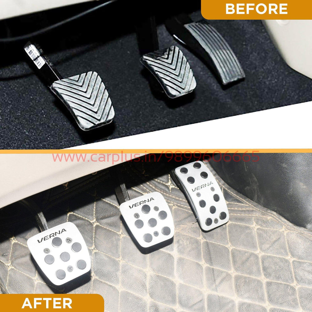 
                  
                    KMH Pedal Kit For Hyundai Verna Fluidic KMH-PEDAL KIT PEDAL KIT.
                  
                