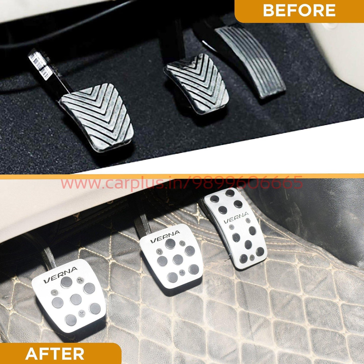 
                  
                    KMH Pedal Kit For Hyundai Verna Fluidic KMH-PEDAL KIT PEDAL KIT.
                  
                