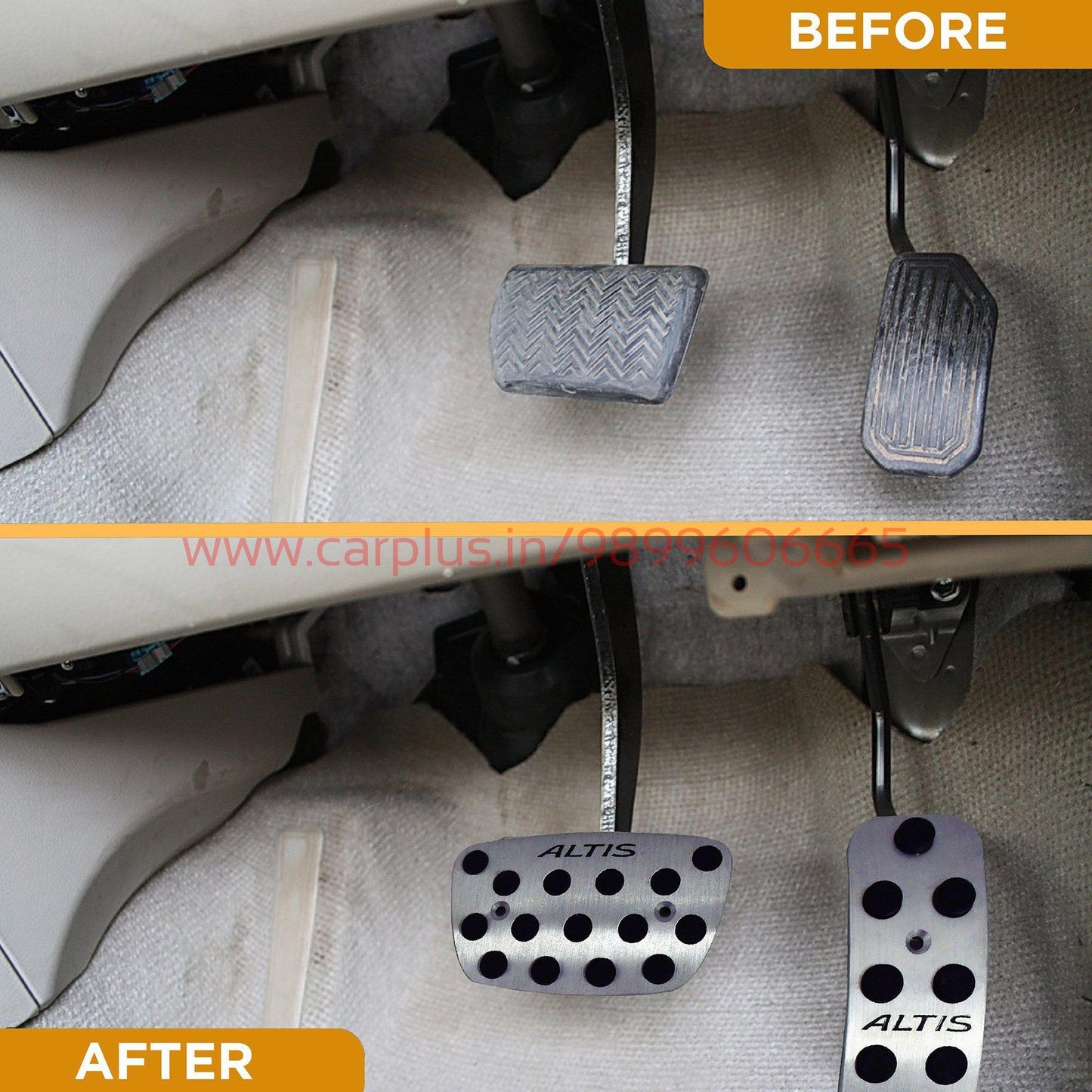 
                  
                    KMH Pedal Kit For Toyota Altis KMH-PEDAL KIT PEDAL KIT.
                  
                