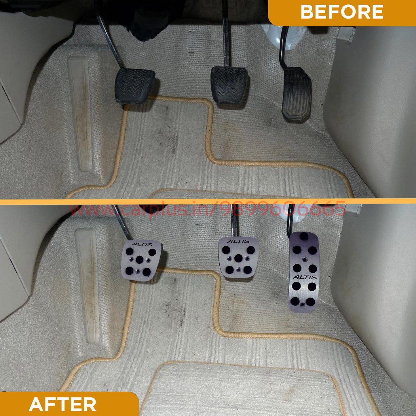 
                  
                    KMH Pedal Kit For Toyota Altis KMH-PEDAL KIT PEDAL KIT.
                  
                