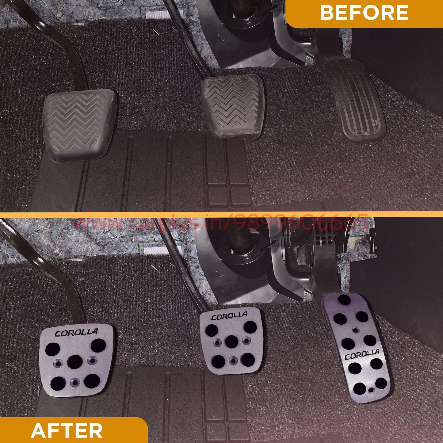 
                  
                    KMH Pedal Kit For Toyota Corolla KMH-PEDAL KIT PEDAL KIT.
                  
                