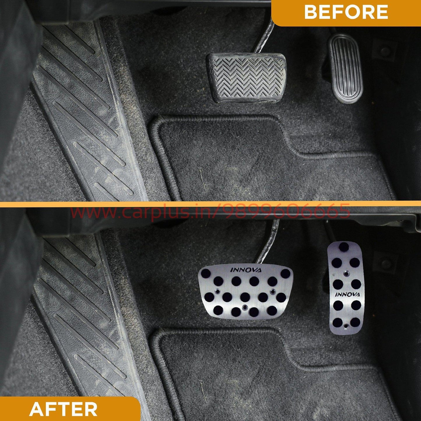 
                  
                    KMH Pedal Kit For Toyota Innova KMH-PEDAL KIT PEDAL KIT.
                  
                